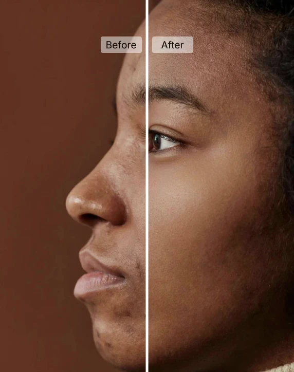 AI Skin Retouching